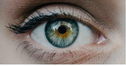 LASIK eye surgery